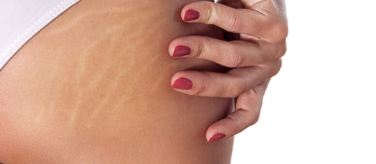 perdre des cuisses